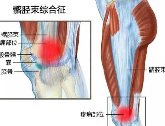 冬天骑车怎么保护膝盖,骑车前怎么保护膝盖