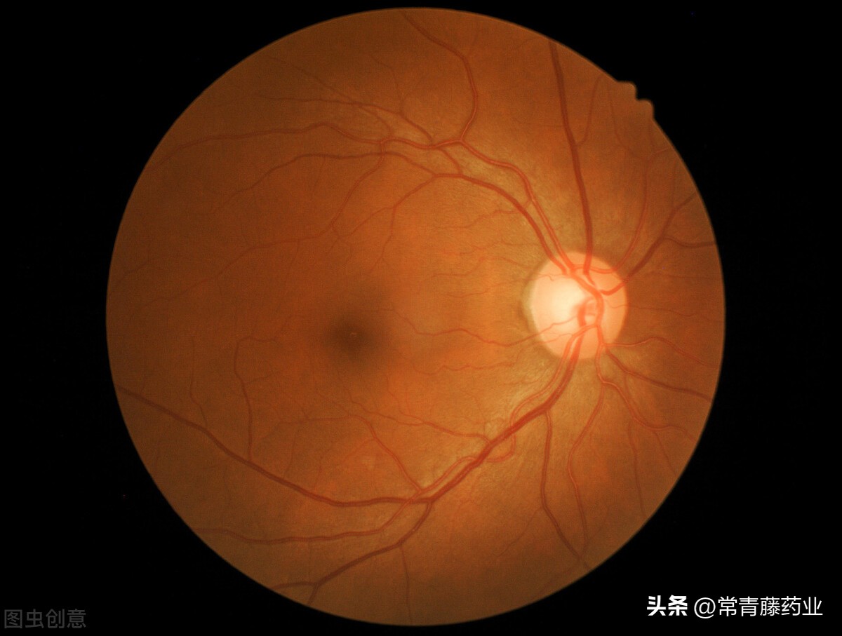 晚上看不清路是夜盲症吗,视网膜病变引起的夜盲症怎么治疗