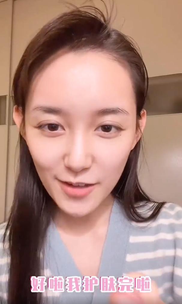 盘点女明星发际线危机,女明星秃头前后对比