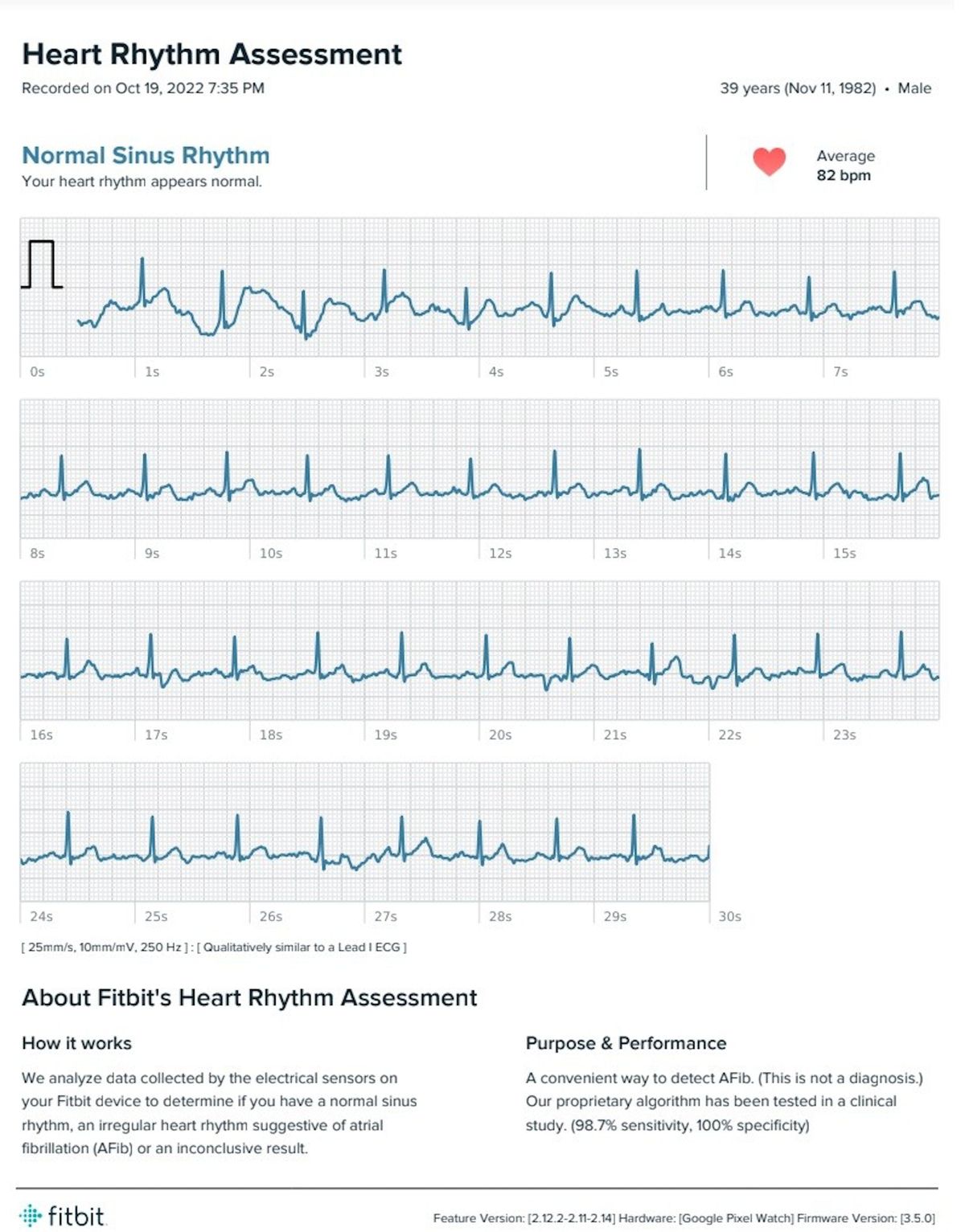GooglePixelWatch手表,googlepixelwatch表盘