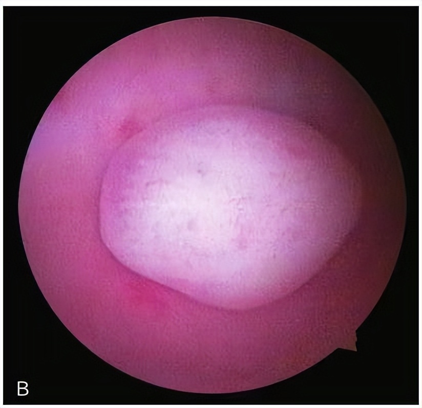 宫腔镜最好的医生,妇科医生科普的14个妇科知识