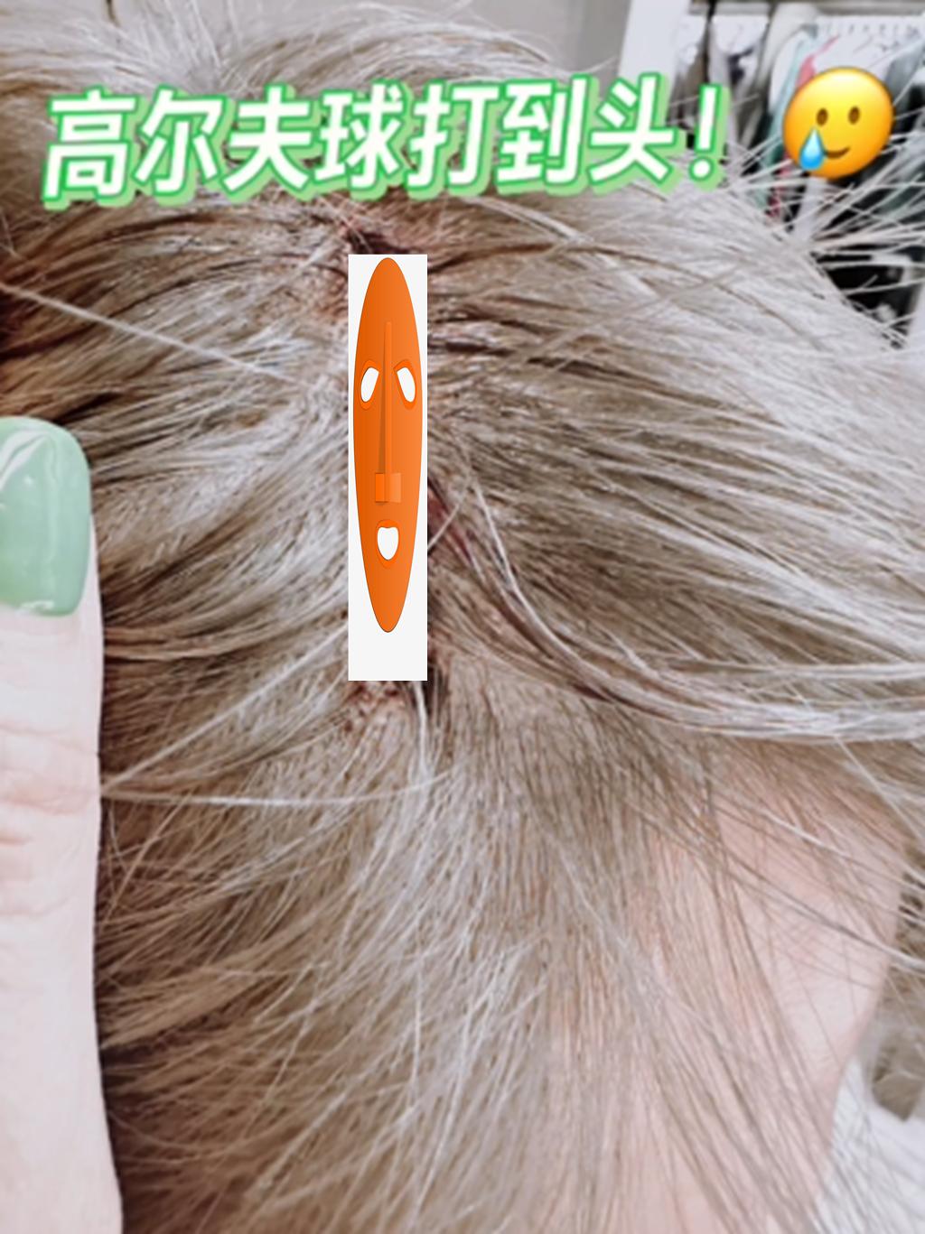 18年前孙耀威事件,孙耀威事件后续