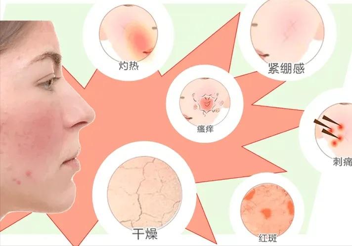 做医美还需要用贵的护肤品吗,做什么医美项目比高价护肤品有用