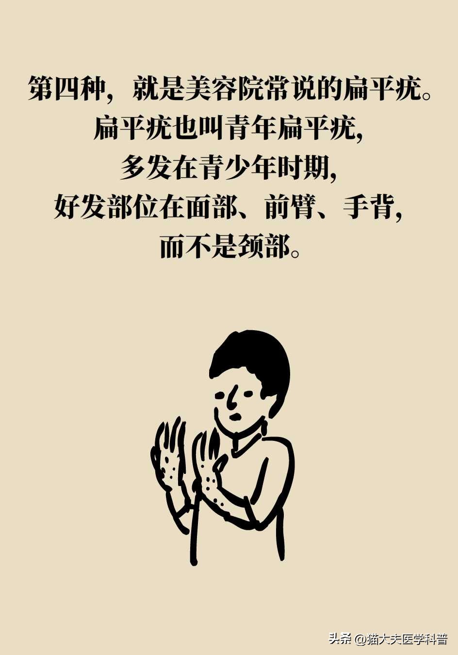 脖子上长的小肉揪怎么治啊,疣丝是不是脖子上的小肉粒