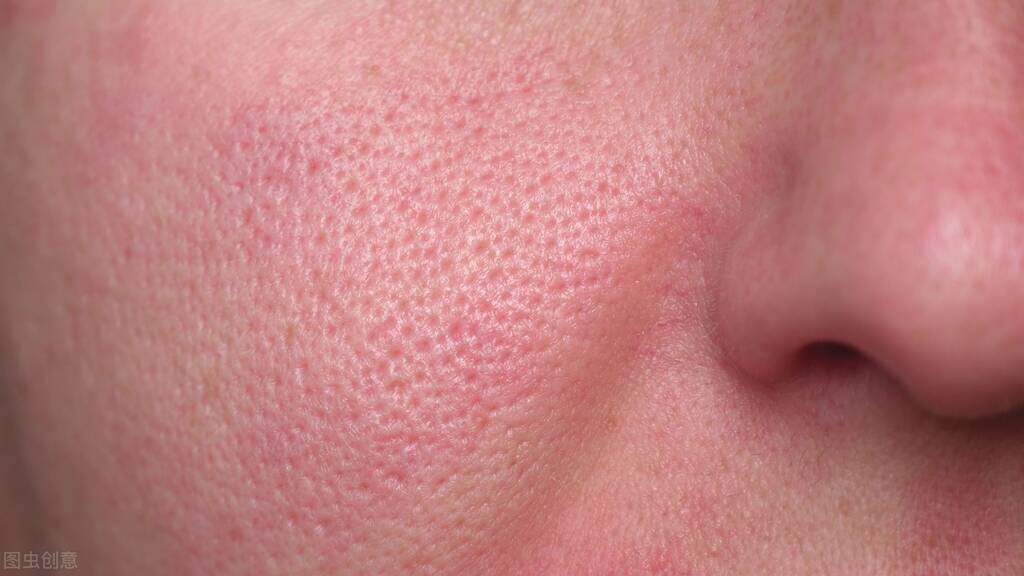毛孔粗大要怎么办教你几招缩回去,毛孔粗大皮肤粗糙没救了吗