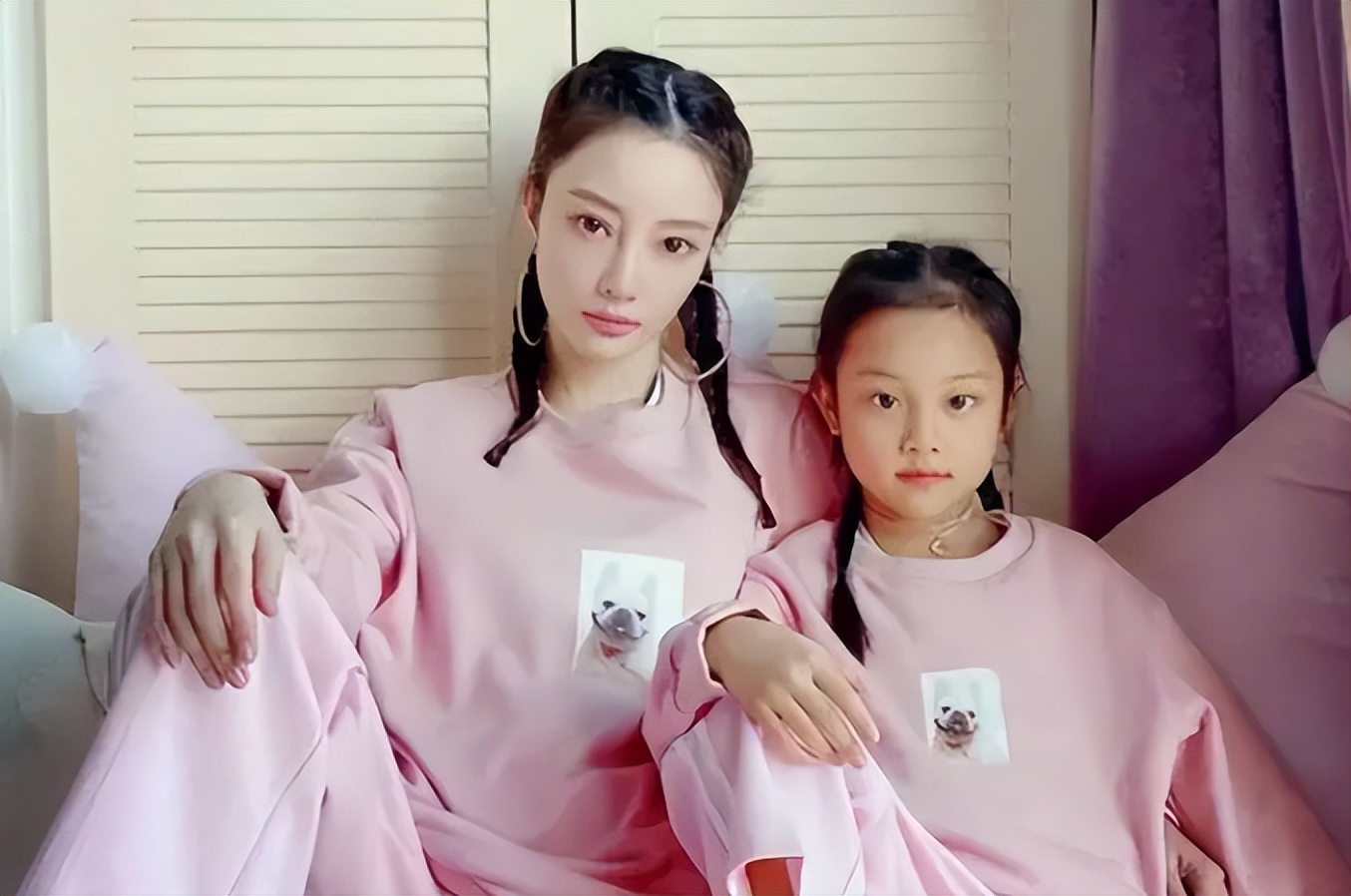 因整容毁掉前途的女星,整容改命的五位明星