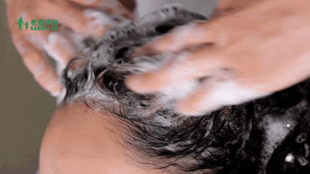 脱发严重用哪款洗发水好,脱发怎么选洗发水成分表