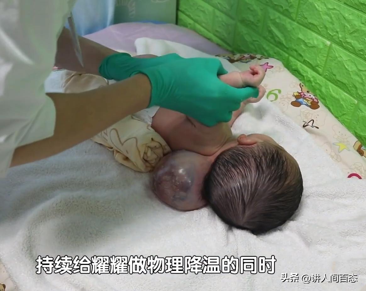 被丢在桥洞下的孩子后续,孩子被遗弃后脑长肿瘤