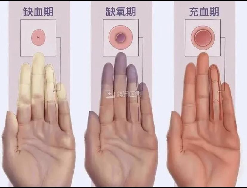 却说遇冷手发紫，尚有源头缺脉动