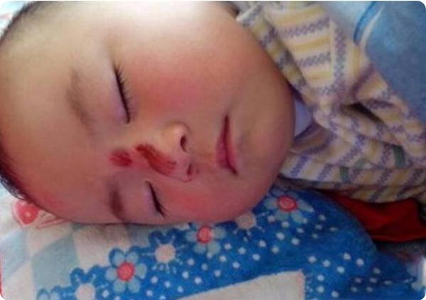 孩子坠床后抱起来,宝宝坠床紧急处理