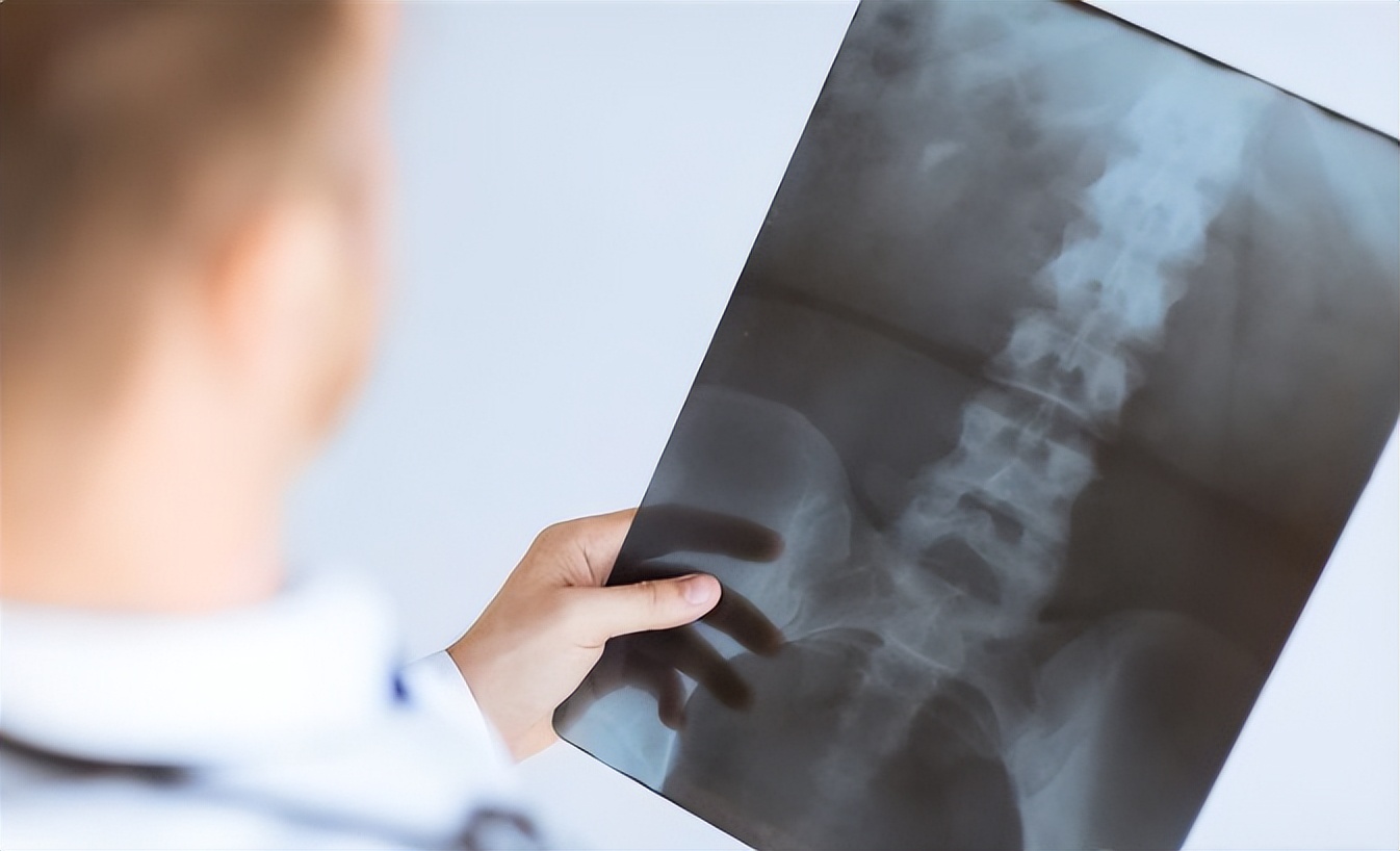 80%的肿瘤患者死于复发转移,74岁癌症晚期转移还能活多久