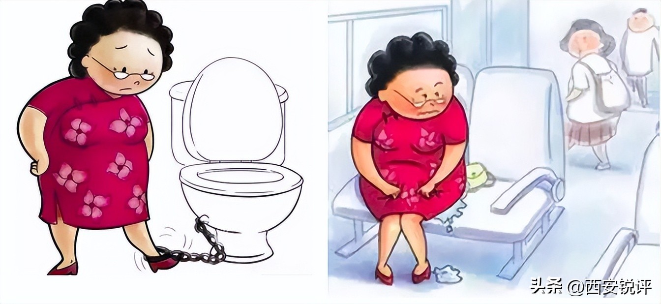 女性隐痛！老人长期漏尿、膀胱掉出阴道，医生针眼微创修复