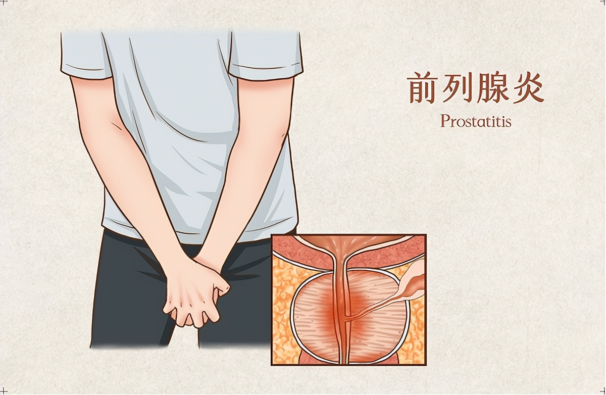 前列腺炎饮食禁忌注意什么,前列腺炎能自愈需注意哪些
