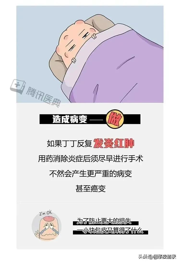 割完包皮后要恢复多久,割完包皮之后要多久恢复