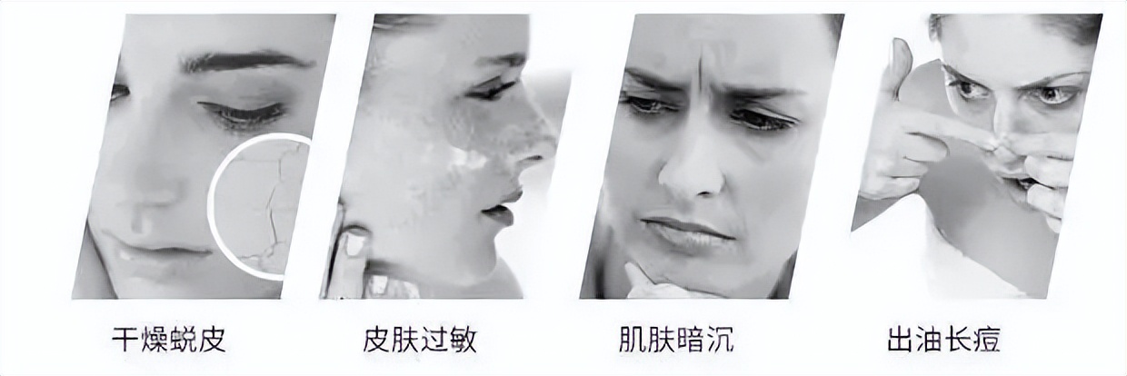 脸干燥起皮怎么办敏感肌,脸起皮干燥紧绷有刺痛感怎么办