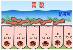 幽门螺旋杆菌挂什么科,幽门螺旋杆菌吃什么药
