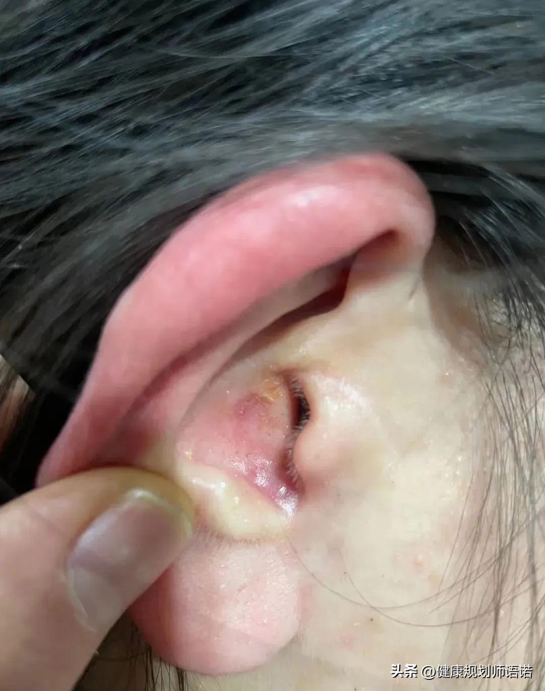 因宫颈问题走进阳光森林，用营养拯救了整个家族的健康