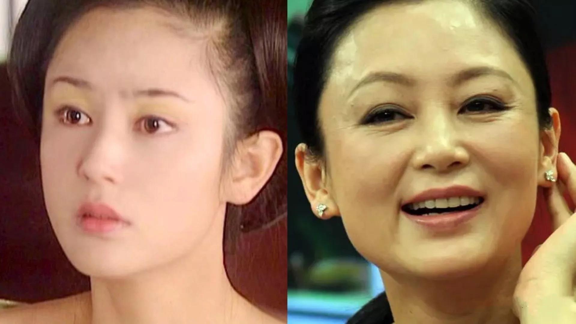 怎样防止脸越来越宽,怎么改善严重的大小脸