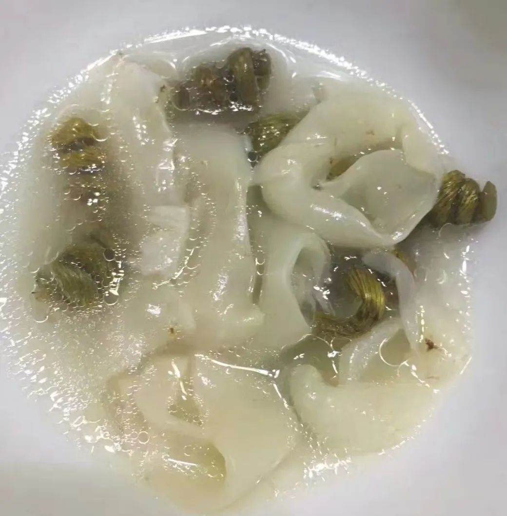 产后适合吃哪种花胶,手术后可以吃花胶吗