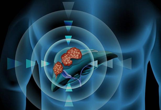 家有乙肝病人其他人怎么办,与乙肝患者接触如何避免被感染