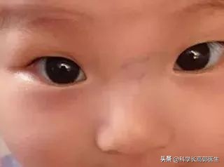 小孩咳嗽反复发烧有什么好方法,孩子咳嗽反复发烧怎么办最有效