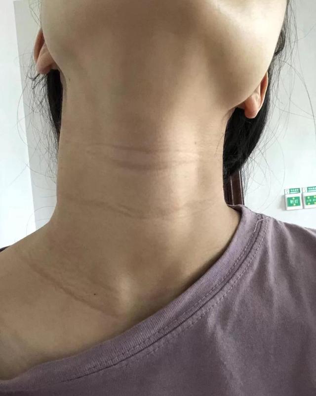 五官显老的女人怎么变年轻,什么样的女人容易显老