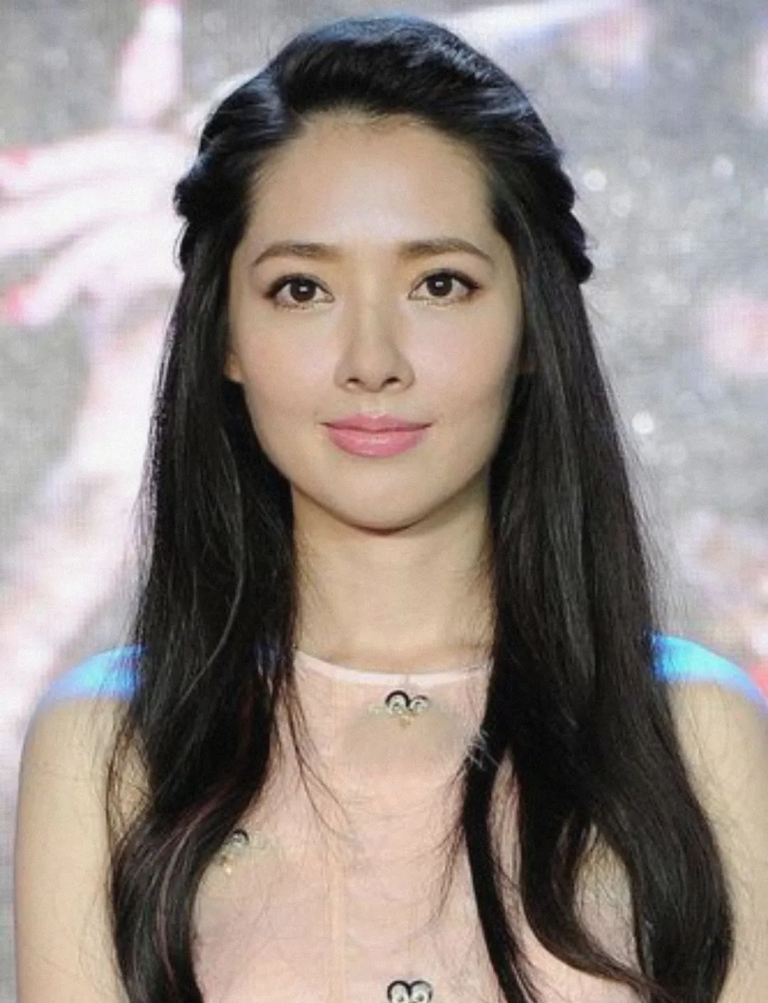 盘点因为整容重回颜值巅峰的明星,眼睛有点歪的明星