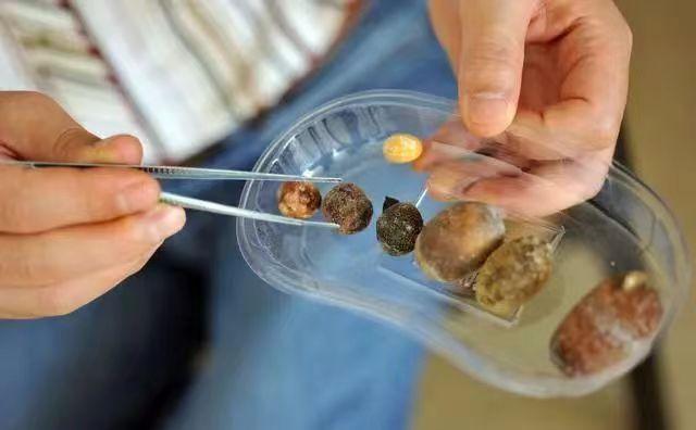 高僧圆寂后为何会出现舍利子,高僧星云大师舍利子