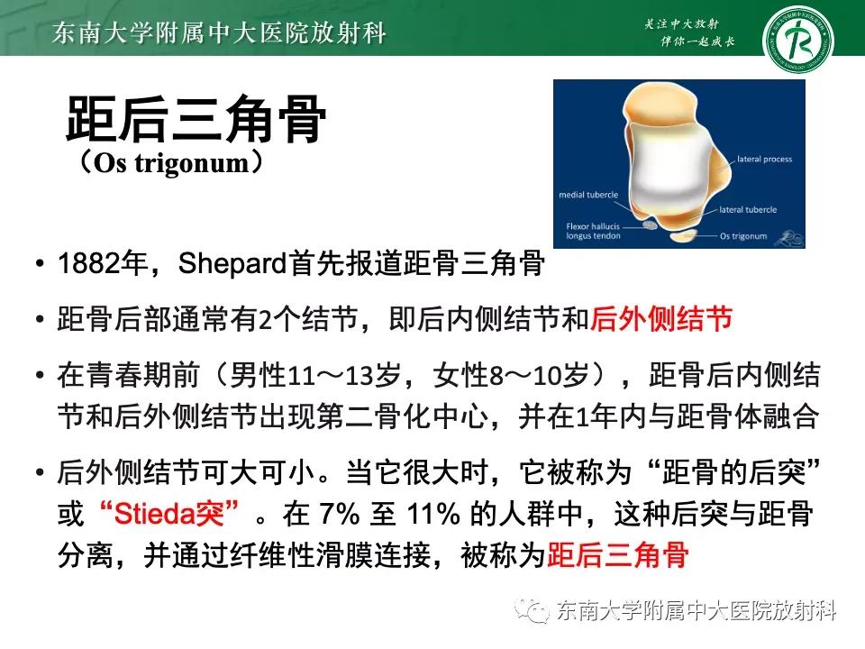 好文分享-《肌骨系统疾病——副舟骨综合征》