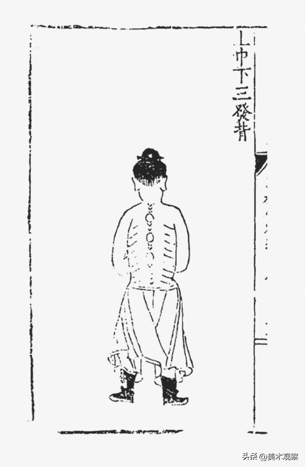 人生最可忧者——重读《灸艾图》