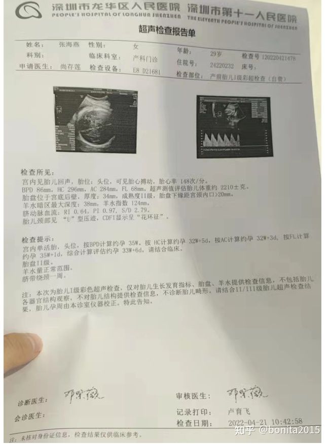 深圳产检怀孕多少周做生育登记,深圳产检生孩子需要什么手续