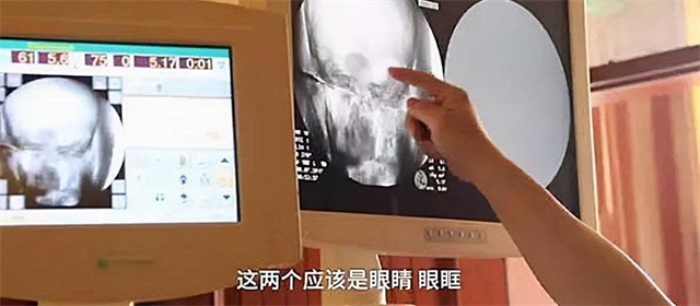 2017年,定慧寺将高僧遗体捐赠国家,体检现场显示:大脑还在