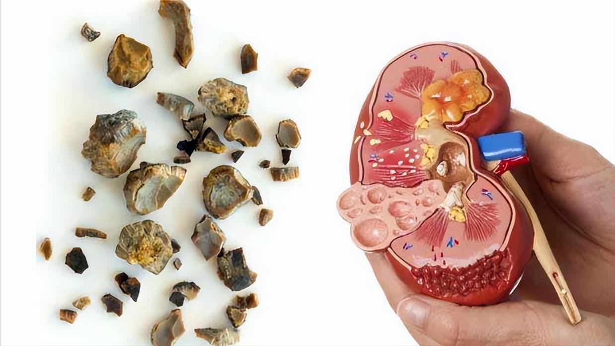 喝柠檬能预防癌症吗,柠檬能抗癌症是真的吗