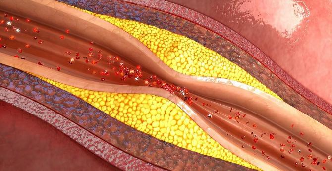 猪油对心脑血管的危害是什么,猪油是心脑血管的杀手是真的吗