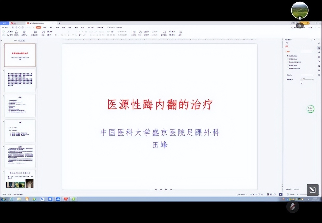 2022年足踝外科康复医学会议,创面修复学术研讨会