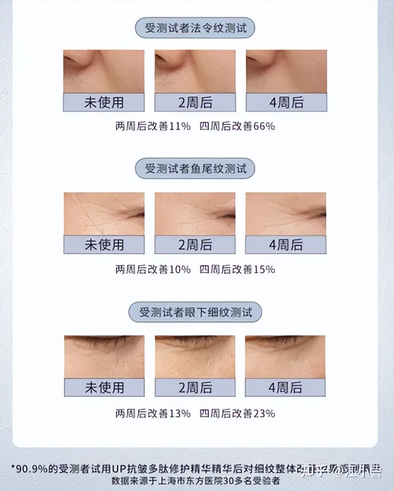 抗衰祛皱纹逆龄变美,紧致抗衰淡法令纹的项目