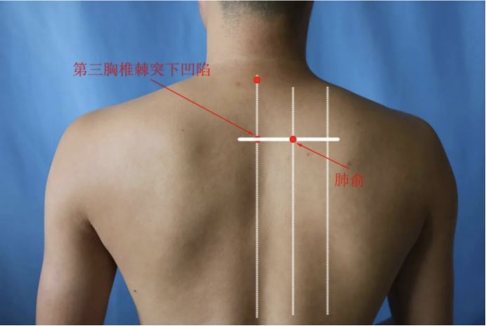 谷医堂保健品,谷医堂扶阳罐