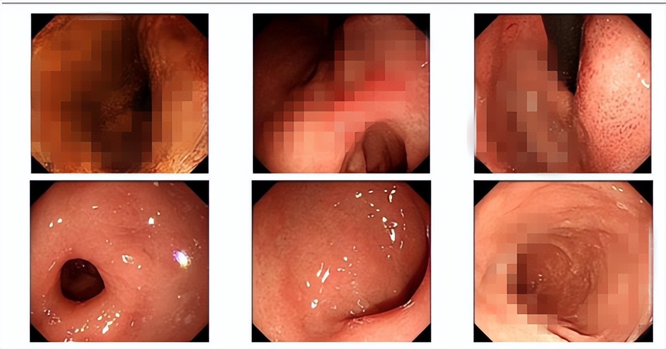 全国治胃癌最好的化疗方案,肿瘤科常见化疗方案解读