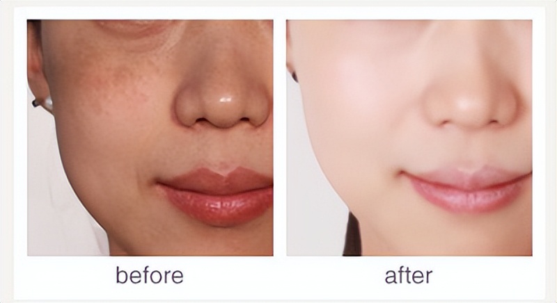 美白淡斑效果好又实惠的护肤品,淡斑美白效果好的护肤品