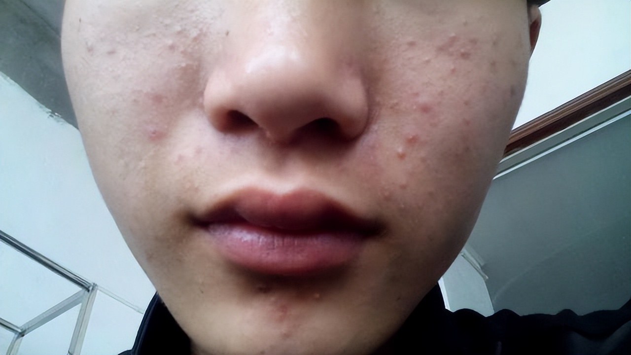 激活雌激素的“冠军”公布？大豆靠边站，女人常吃，彰显个人魅力