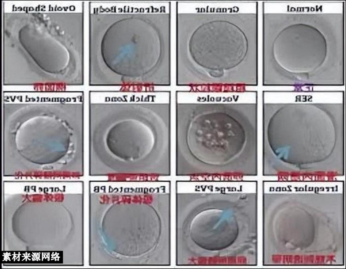 科学家发现人类精子和卵子,科学家发现精子与卵子