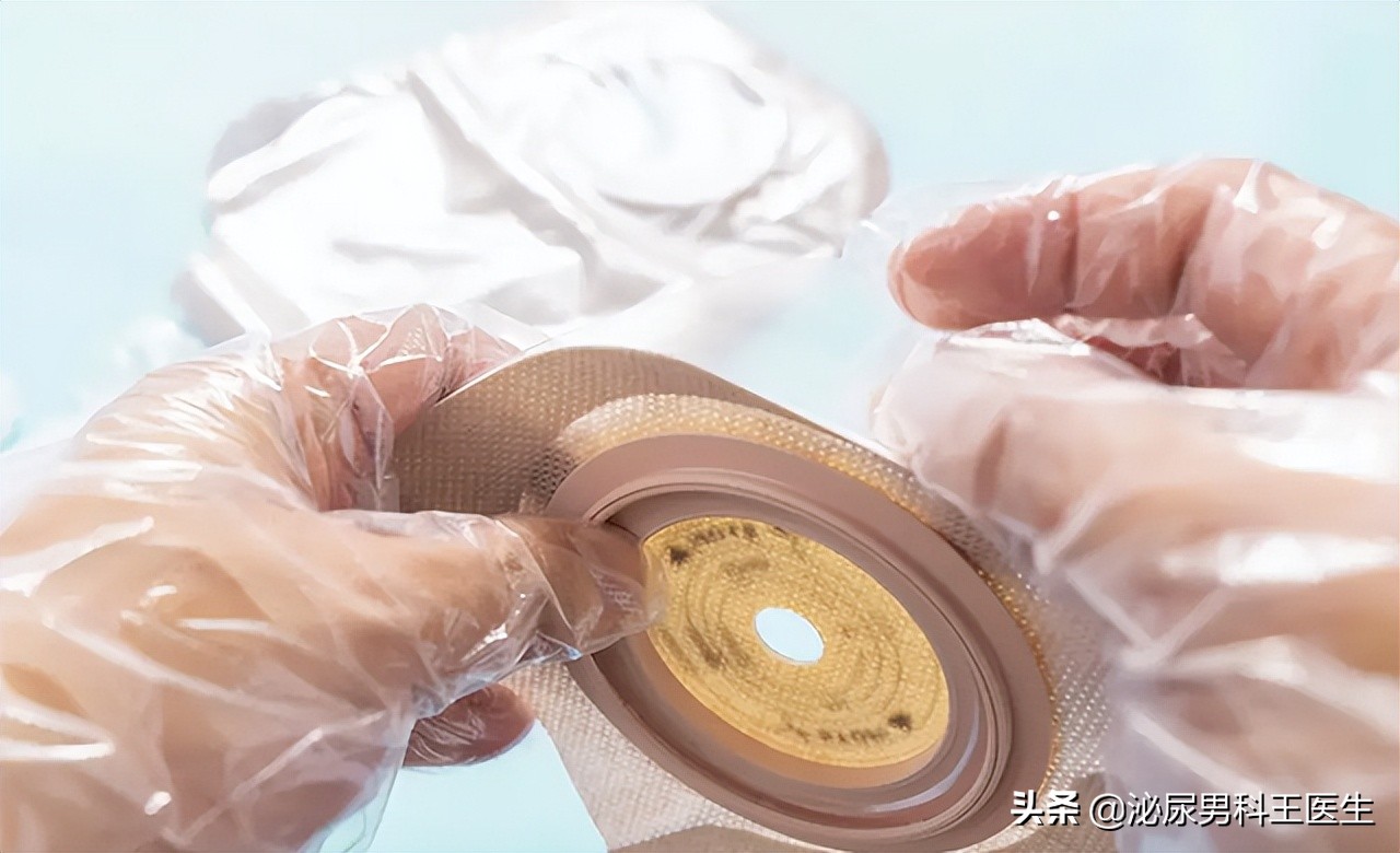 直肠癌的6个早期症状是一起出现,直肠癌出现便秘早期还是晚期