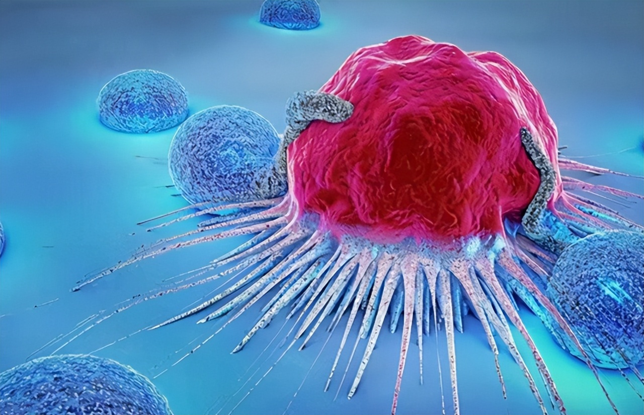 从炎症到癌症,一般需要多长时间?医生:3种炎症,尽量不要拖