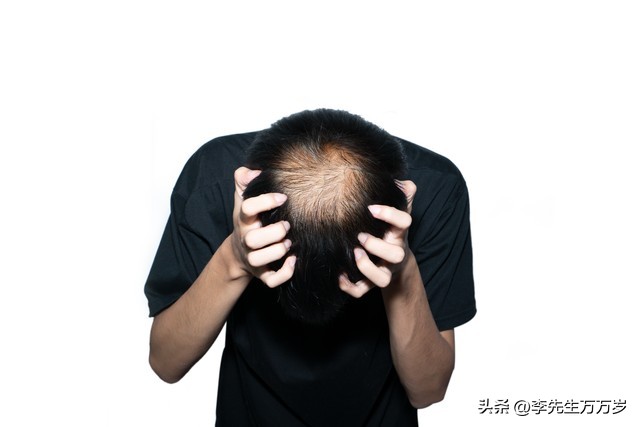 年轻人还在为秃头掉发而烦恼吗,18岁秃头越来越严重是什么原因