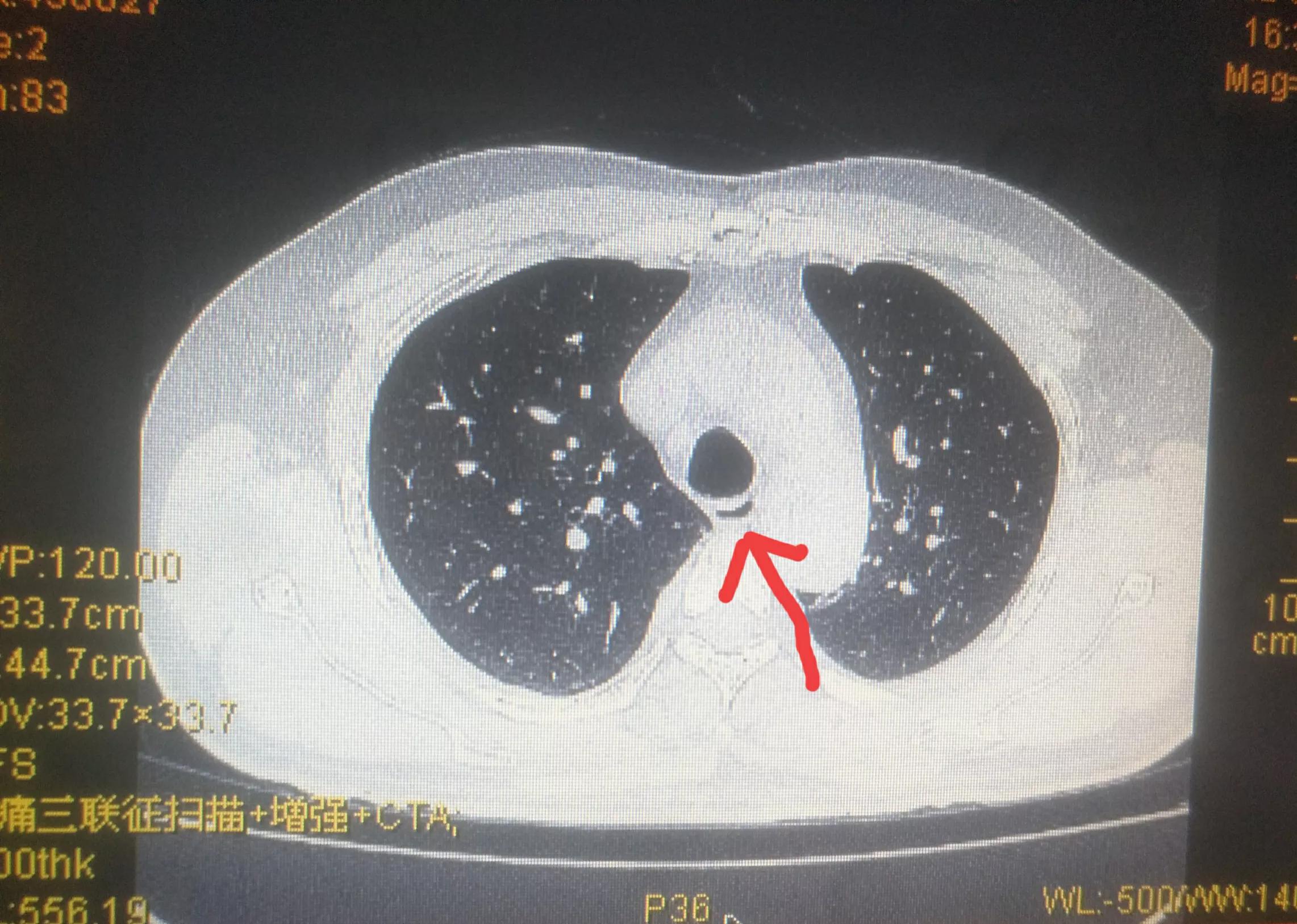 男子腹痛确疑病症,男子腹痛难忍医生怀疑