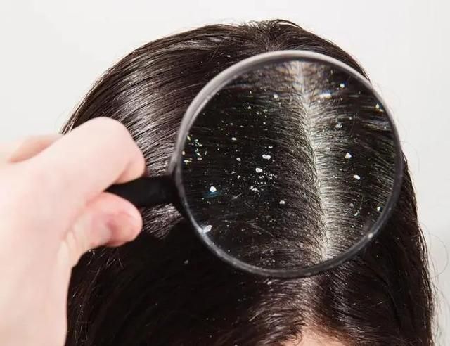 头皮上长红疙瘩脓包是什么原因,头皮经常起小脓包疙瘩很疼