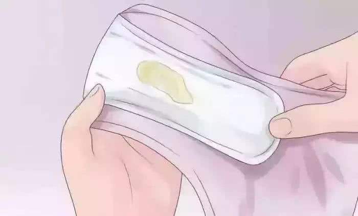 小腹胀痛白带发黄是什么妇科病,妇科白带发黄怎么回事