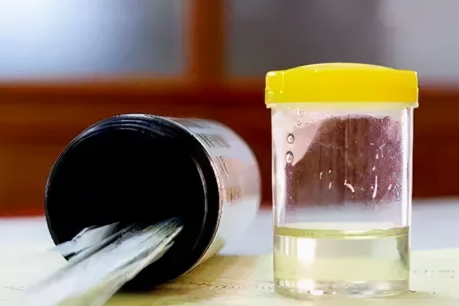 痛风晚上发作没有药怎么快速止痛,痛风经常发作怎么办