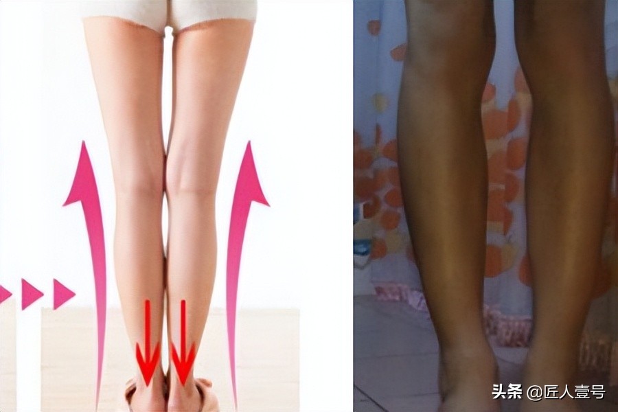 臀部下垂穿提臀裤可以改善吗,为什么屁股下垂严重