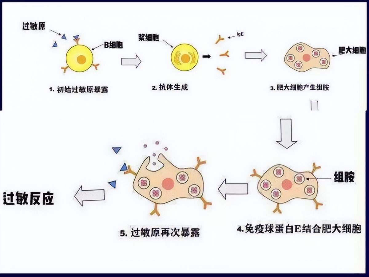 对猫咪过敏的症状怎么消除,如何看是不是对猫咪过敏